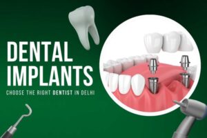 best dental clinic delhi
