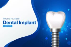 Best implant dentist near me