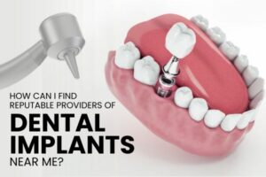 Dental implantology near me