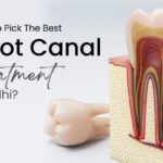 Affordable Root Canal Therapy