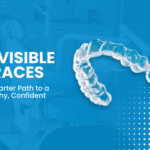 Invisible/Invisalign Braces Treatment