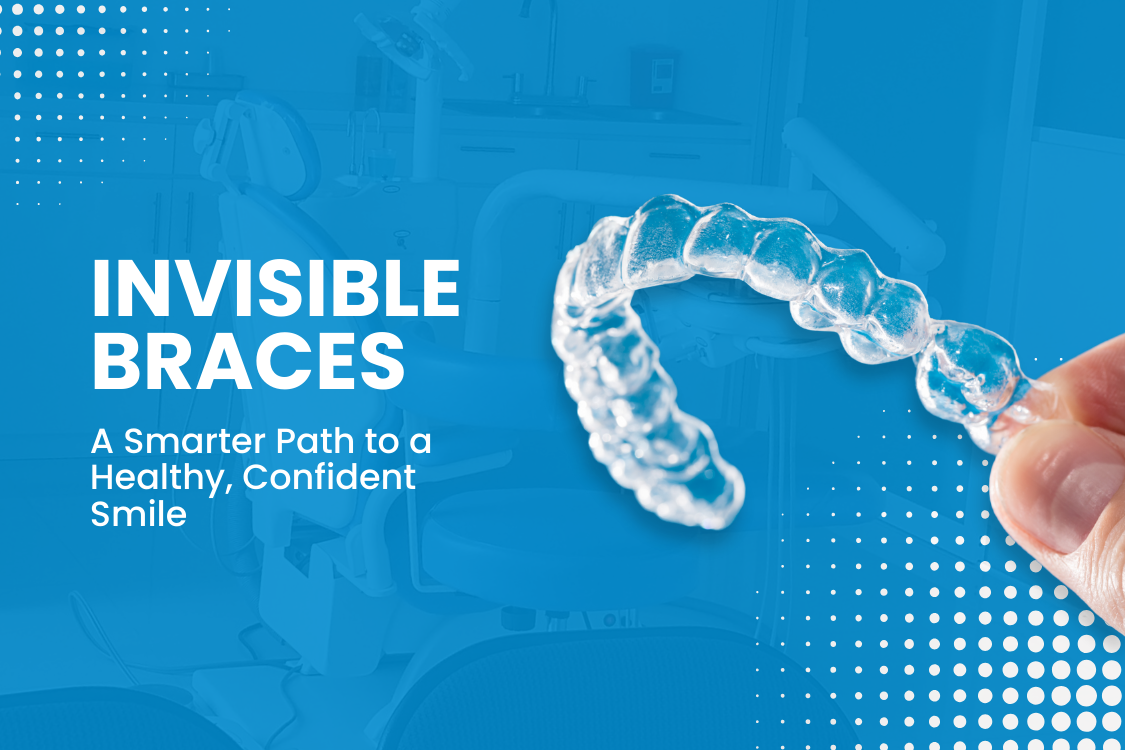 Invisible/Invisalign Braces Treatment