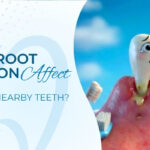 best root canal treatment in delhi