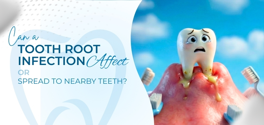 best root canal treatment in delhi