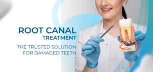 best root canal treatment in delhi