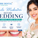 best dental clinic in delhi