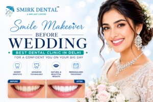 best dental clinic in delhi