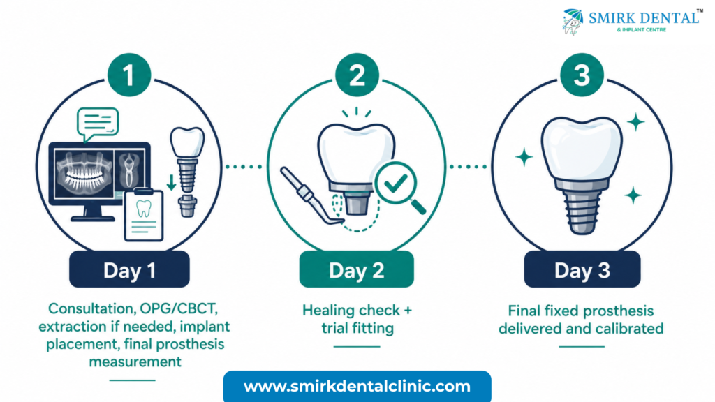 3 day dental implant timeline Delhi – Smirk Dental