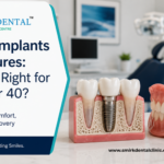 Dental implants vs dentures after 40 – Smirk Dental Laxmi Nagar