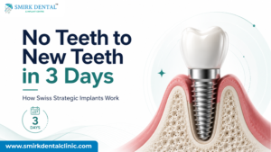 Swiss Strategic dental implant timeline – teeth in 3 days Delhi