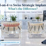 All-on-4 vs Swiss Strategic Implants comparison for full arch dental implants in Delhi.