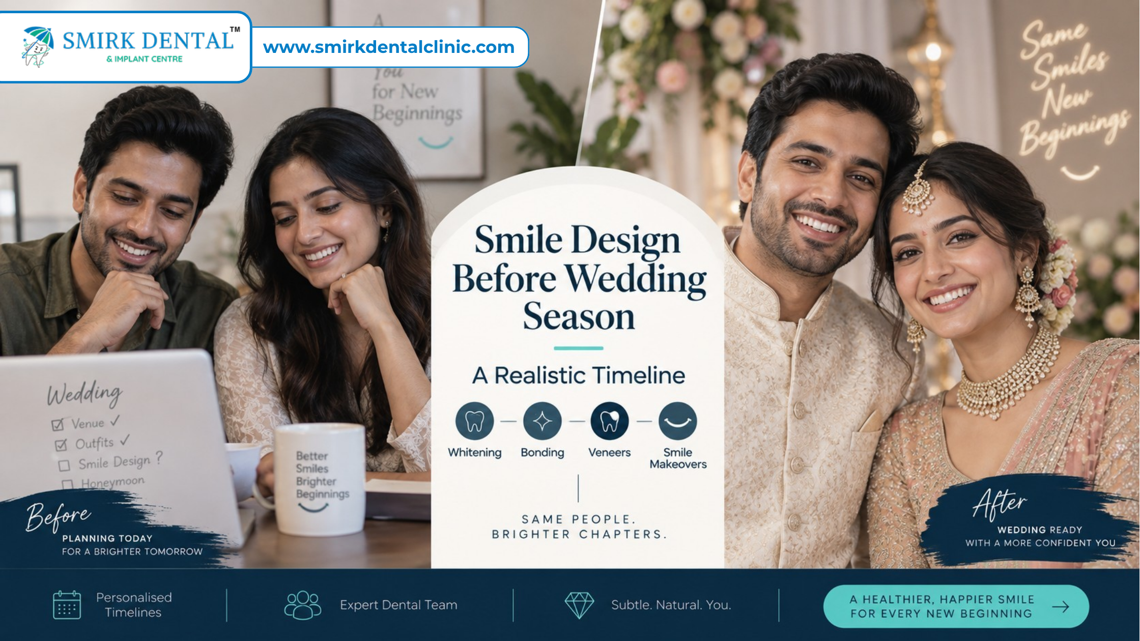 Smile design before wedding in Delhi with realistic treatment timeline