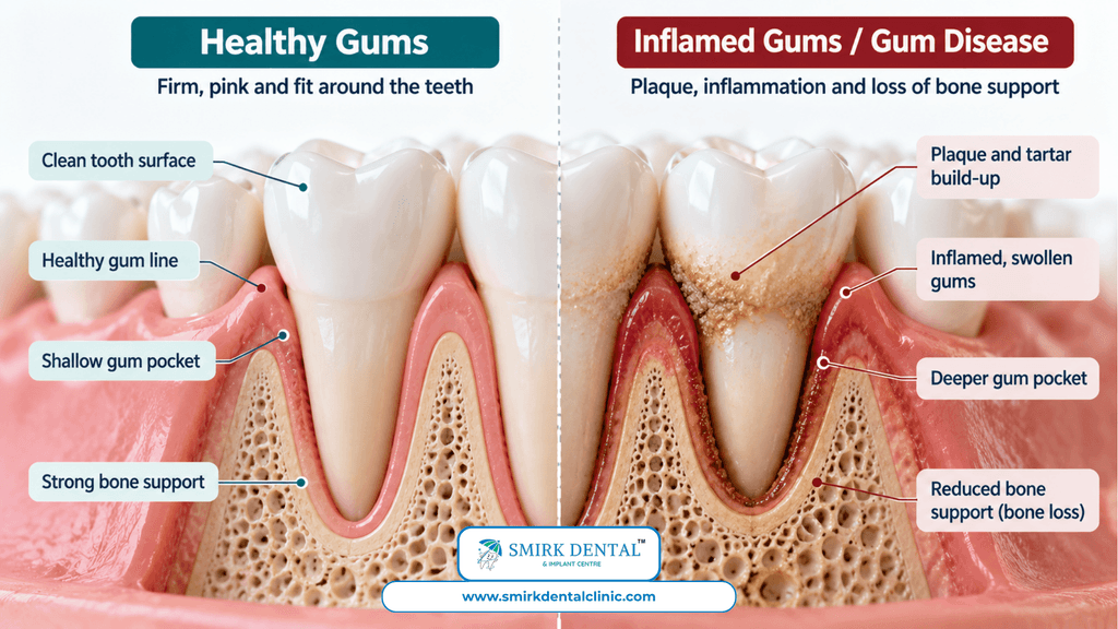 Healthy gums and teeth comparison diagram